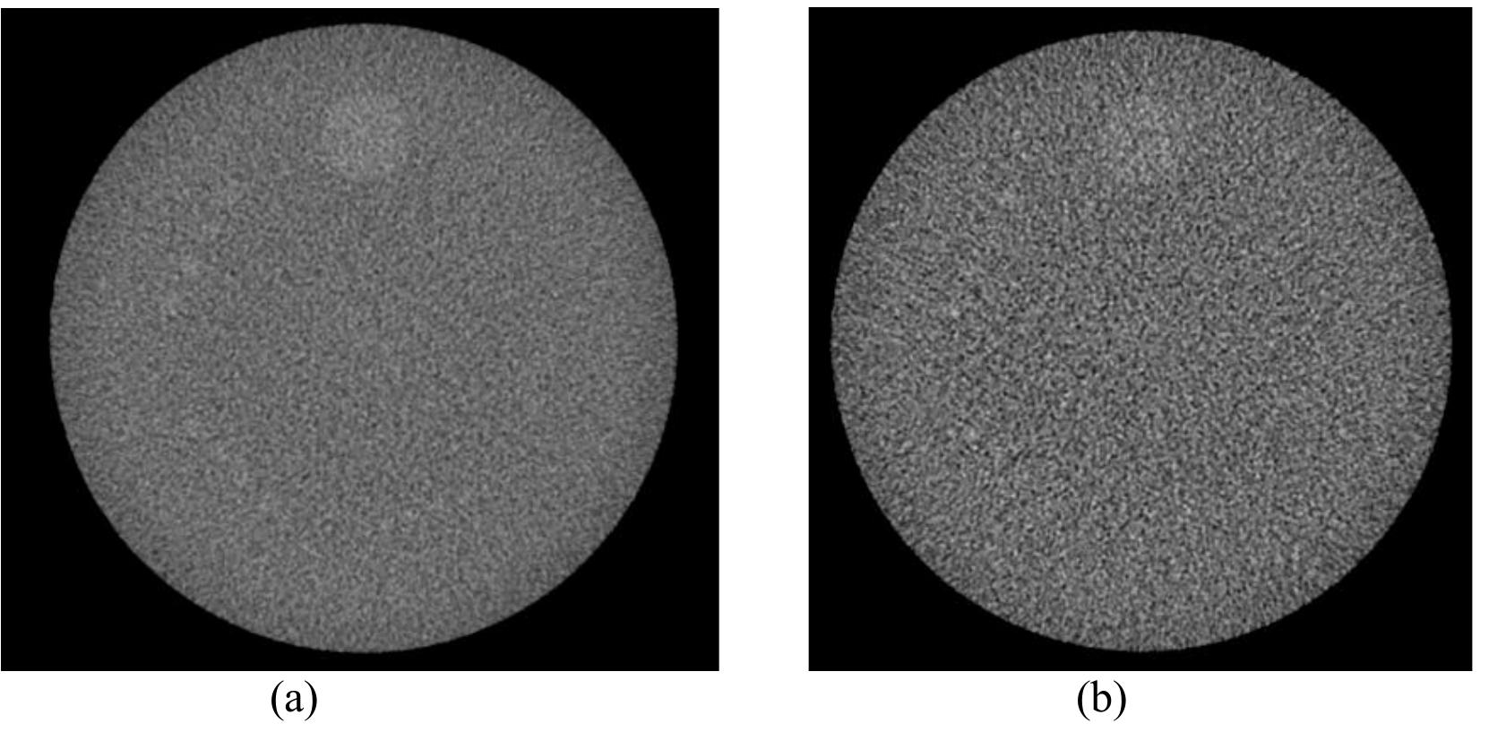 (PDF) Tradeoffs in CT Image Quality and Dose