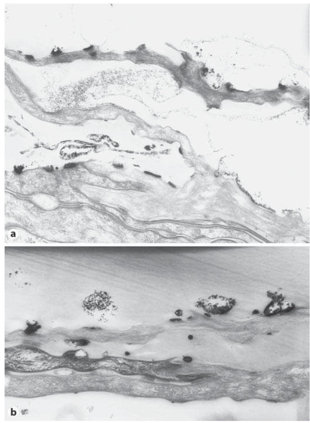Electron micrographs of human skin showing zno nanoparticle