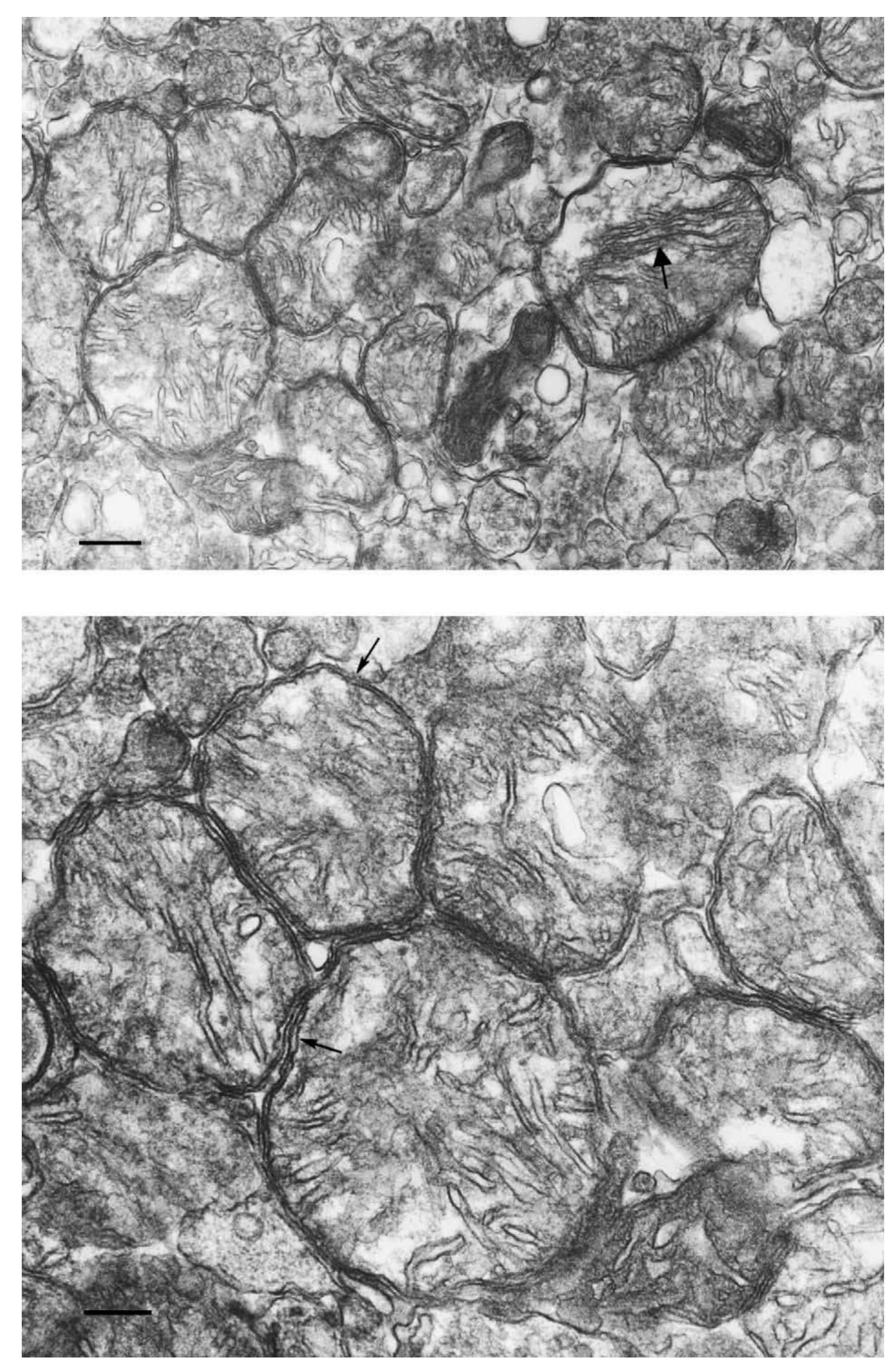 (PDF) Nitrogen disruption of synaptoneurosomes: an alternative method ...