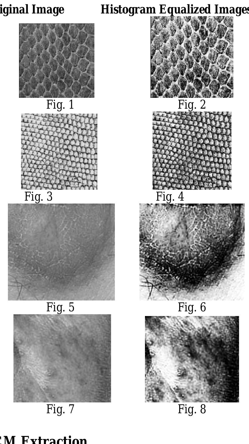 (PDF) Human Skin Texture Analysis using Image Processing Techniques