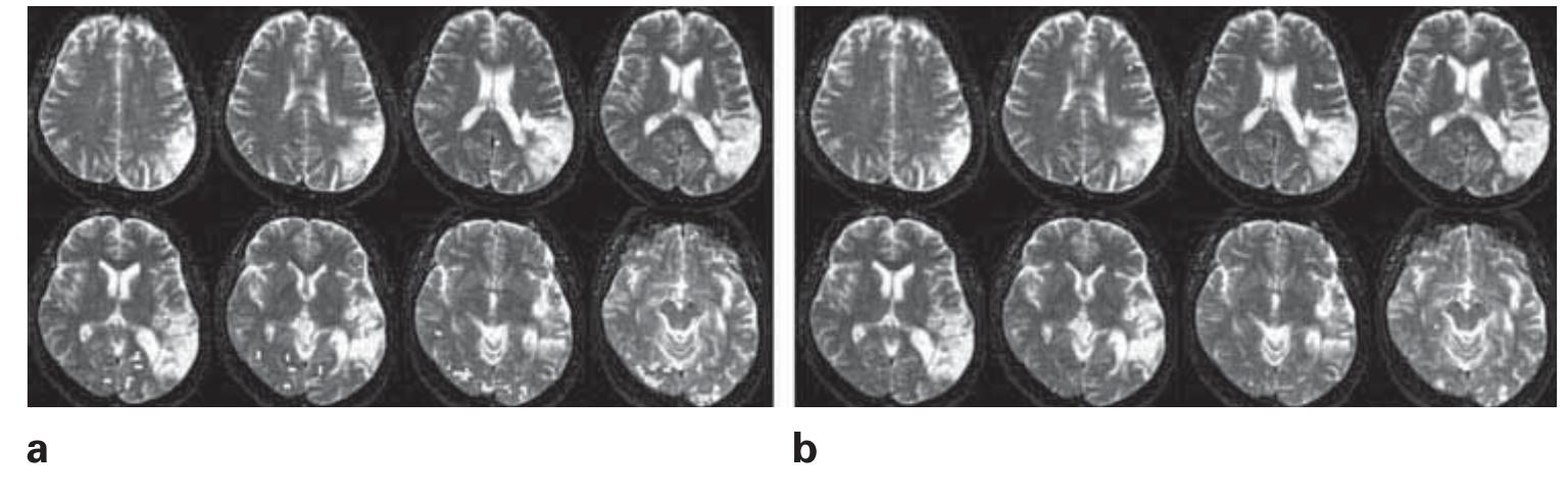 PDF) The Cognitive Neuroscience of Mind: A Tribute to