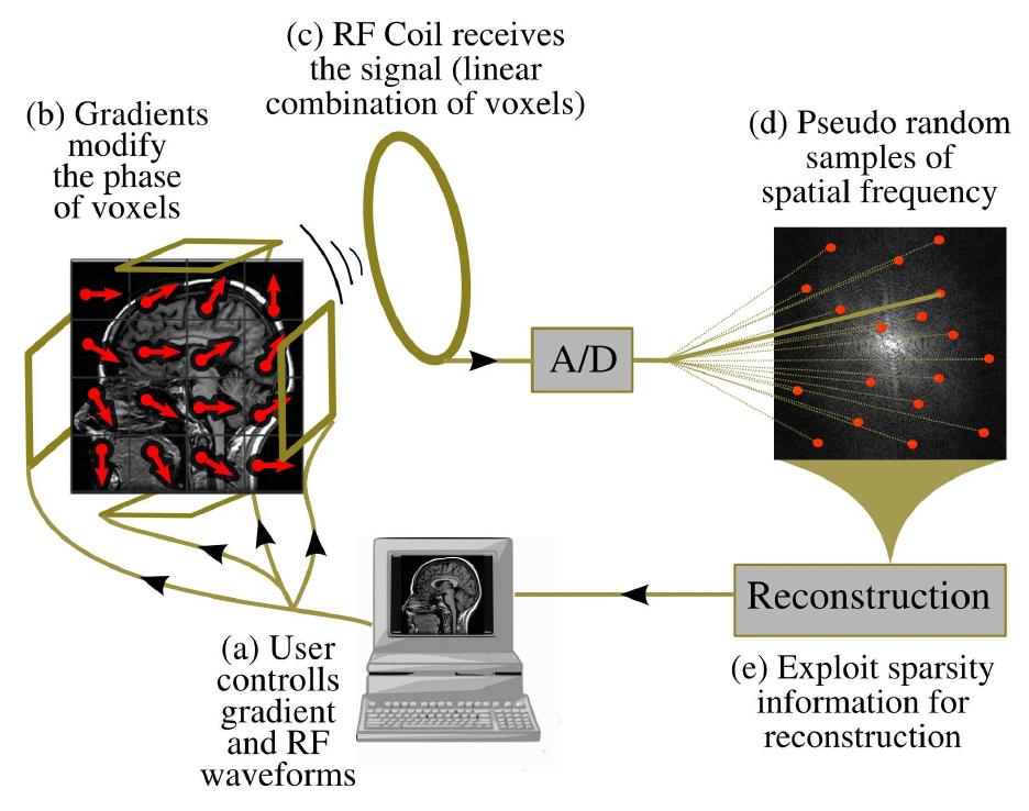 (PDF) Compressed Sensing MRI