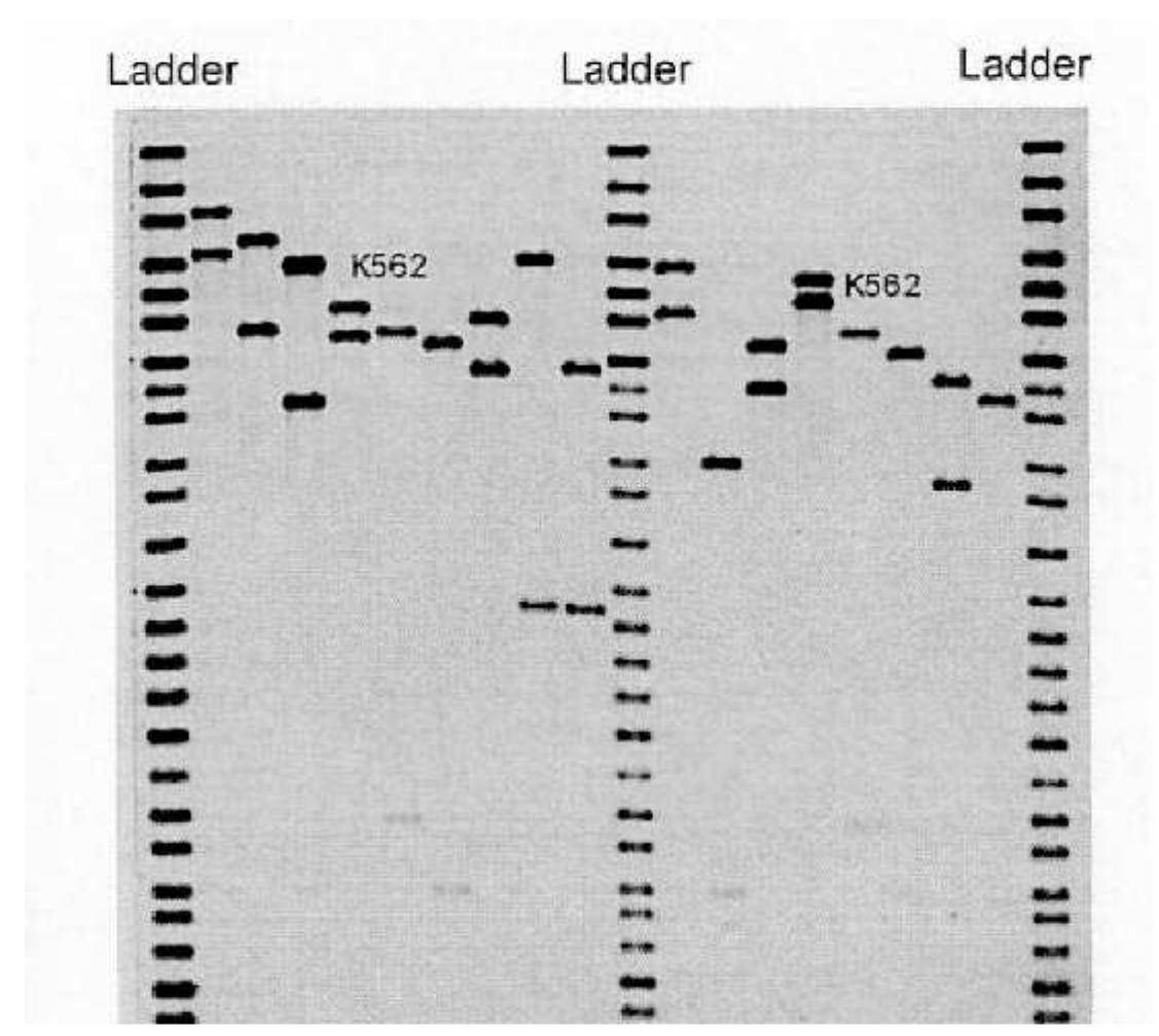 Probing Ladder (PDF) An Introduction to Forensic Genetics