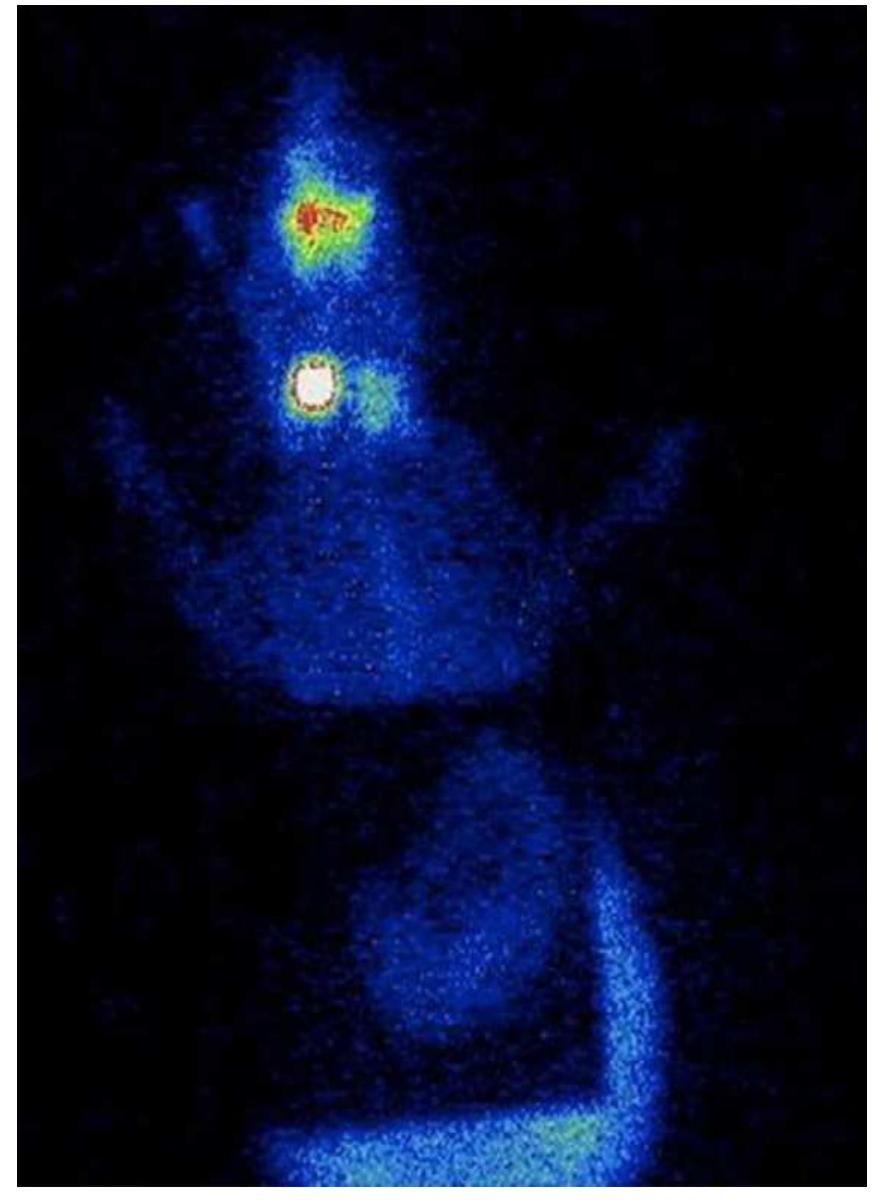 (PDF) Hyperthyroidism in a Guinea pig