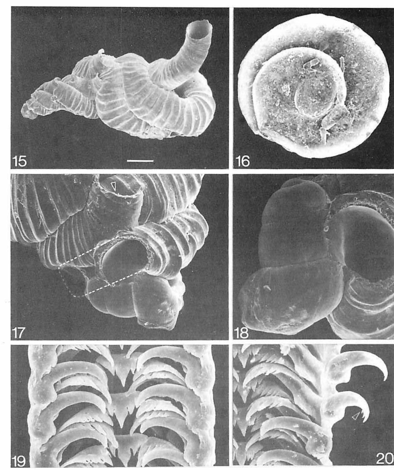 (PDF) Vermetid gastropods from Sao Miguel, Azores: Comparative anatomy ...