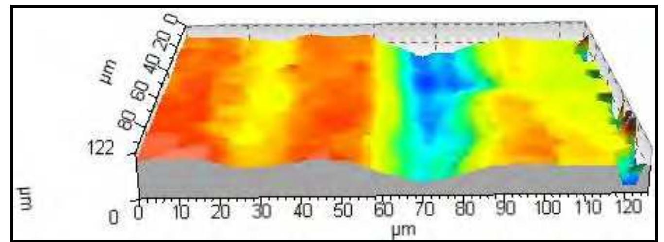 Figure 37. Cutmarks on cranial fragment from 12Sp7. This image is at a lower magnification than Figures 35 and 36 to emphasize the shallowness of two separate cuts (in yellow to left and in blue to aqua on right) (10X). 