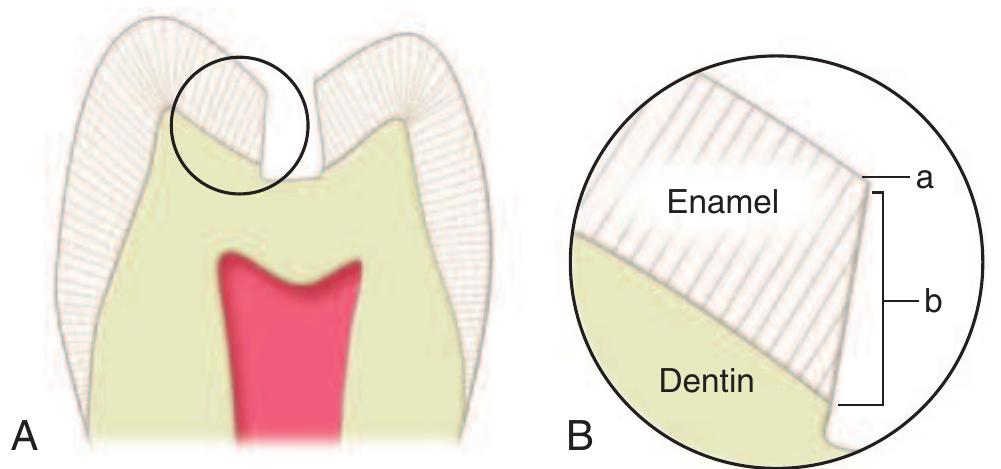 (PDF) STURDEVANT'S ART AND SCIENCE OF OPERATIVE DENTISTRY - SOUTH ASIAN ...