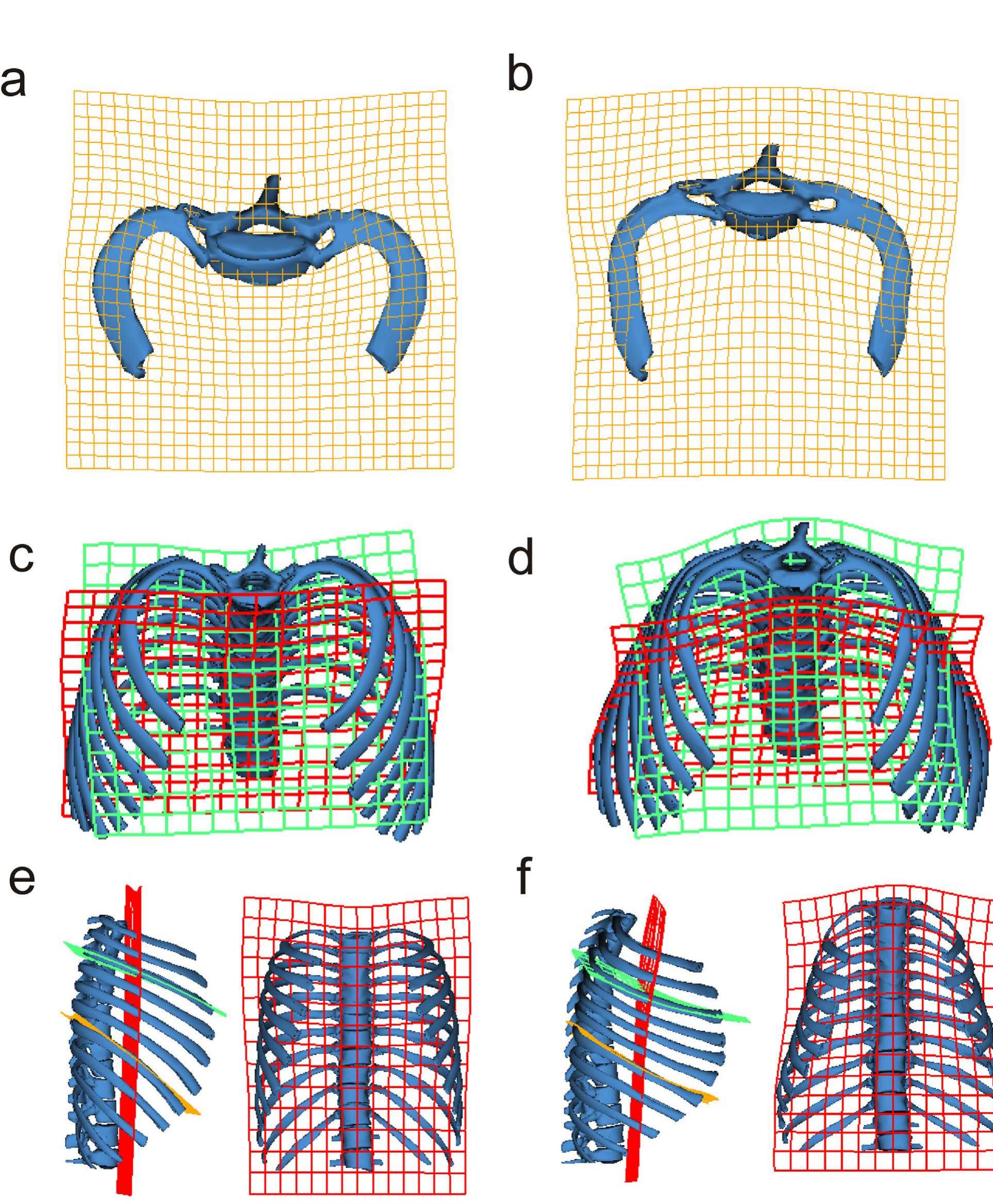 Cranial views of neandertals from el sidroén compared with