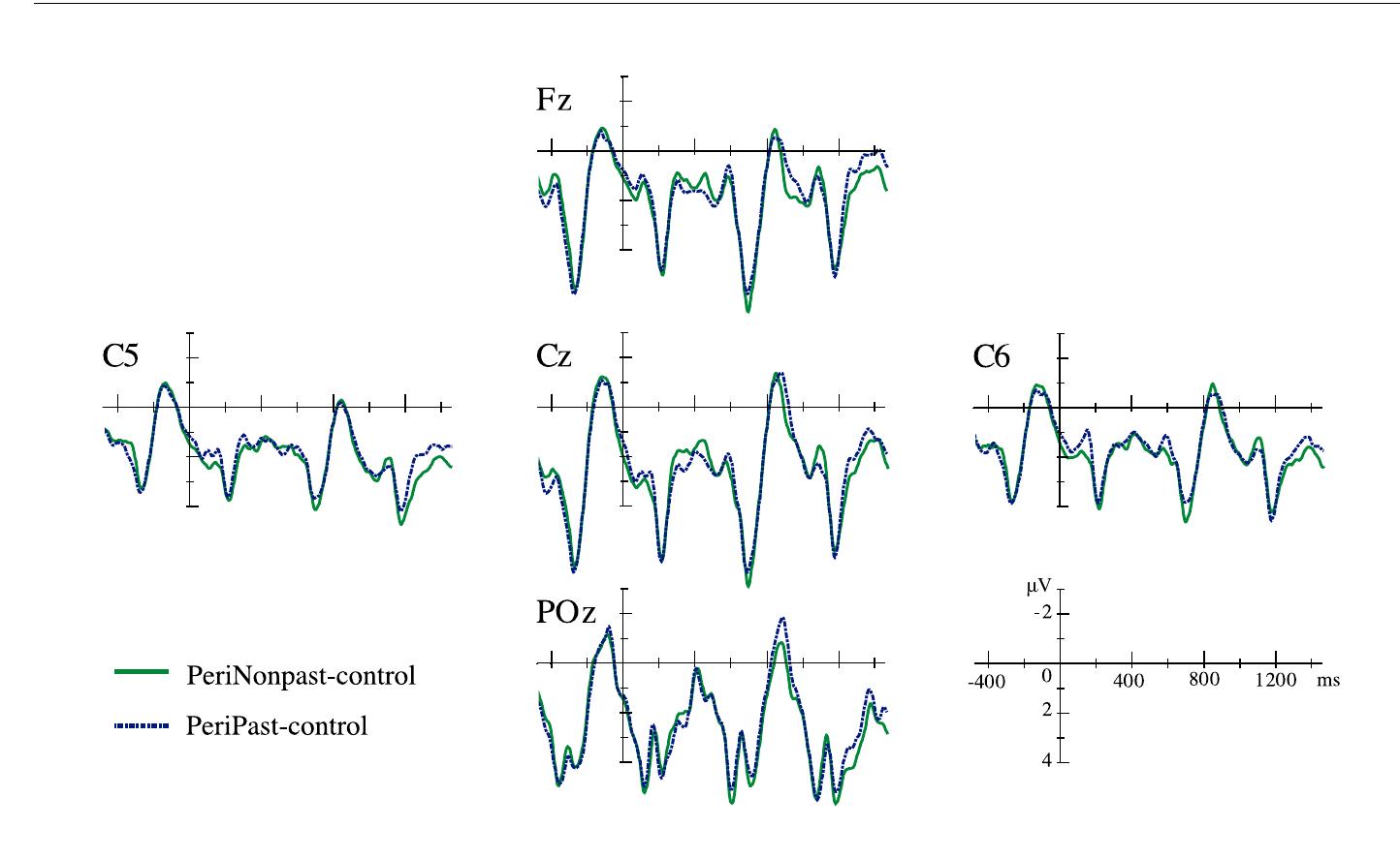 Figure 9 - from The brain, verbs, and the past: