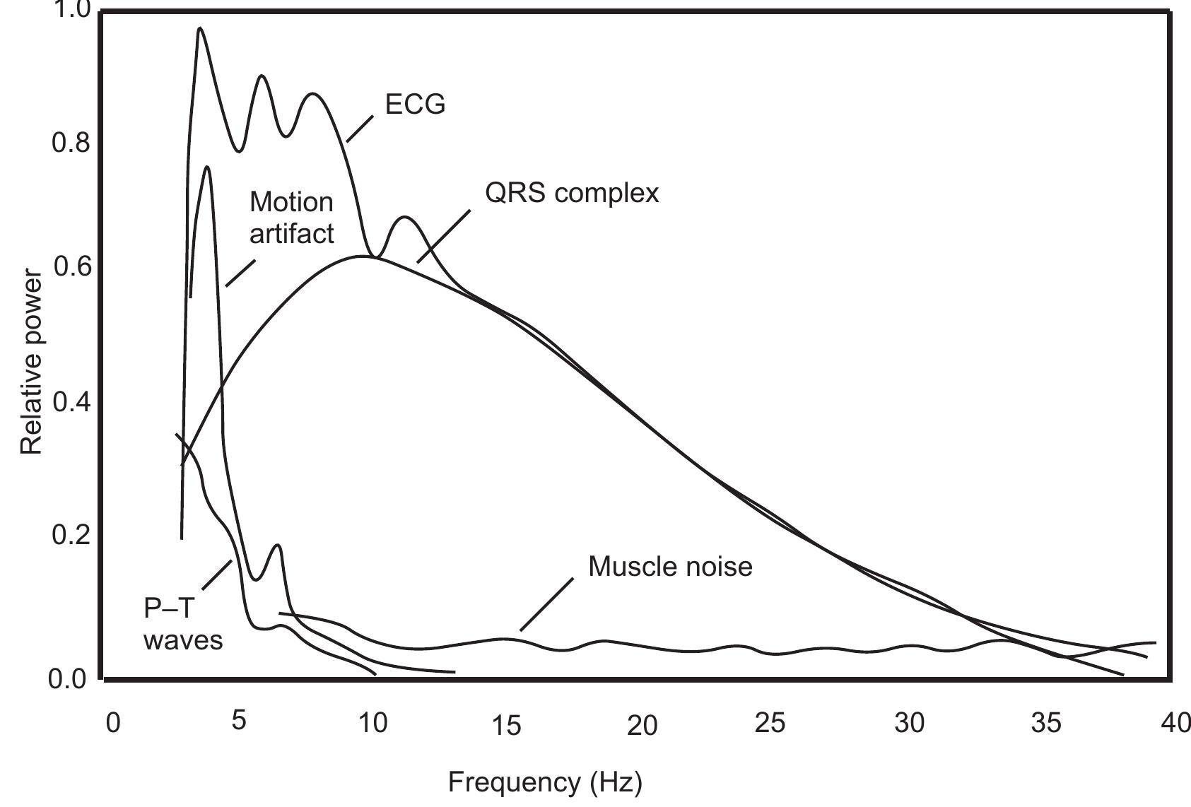 Figure 1 - from ECG QRS Detection