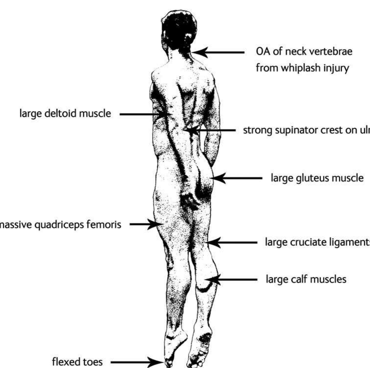 Joan Oates, Theya Molleson & Arkadiusz Sottysiak  Figure 7. A professional dancer performing a jump turn shows the extreme development of many of the muscles seen on FS 1374C from Tell Brak. After a photograph by Jacques Grenier. 