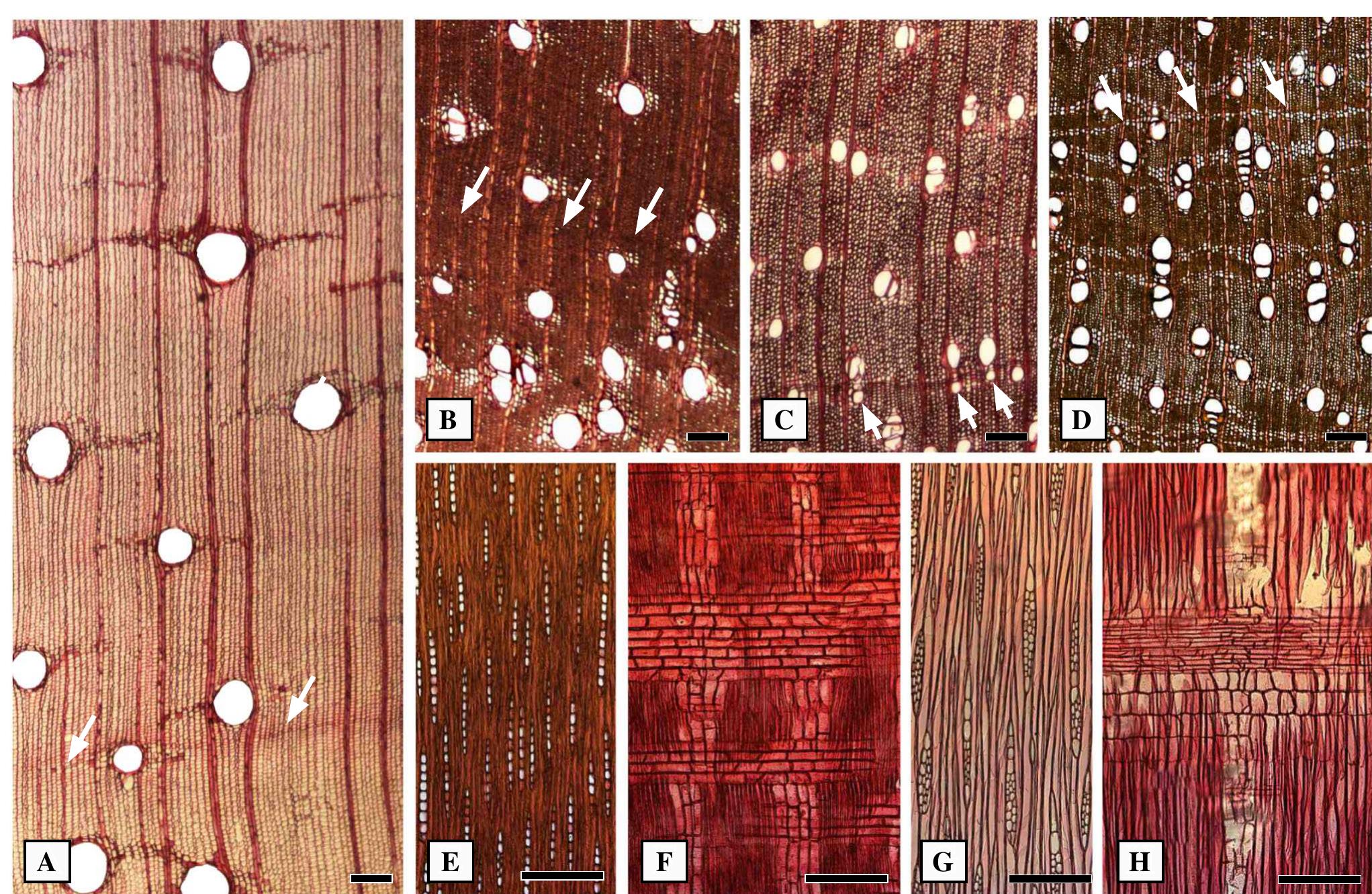 Multiseriate Rays Wood anatomy of the tabebuia alliance (including crescen-