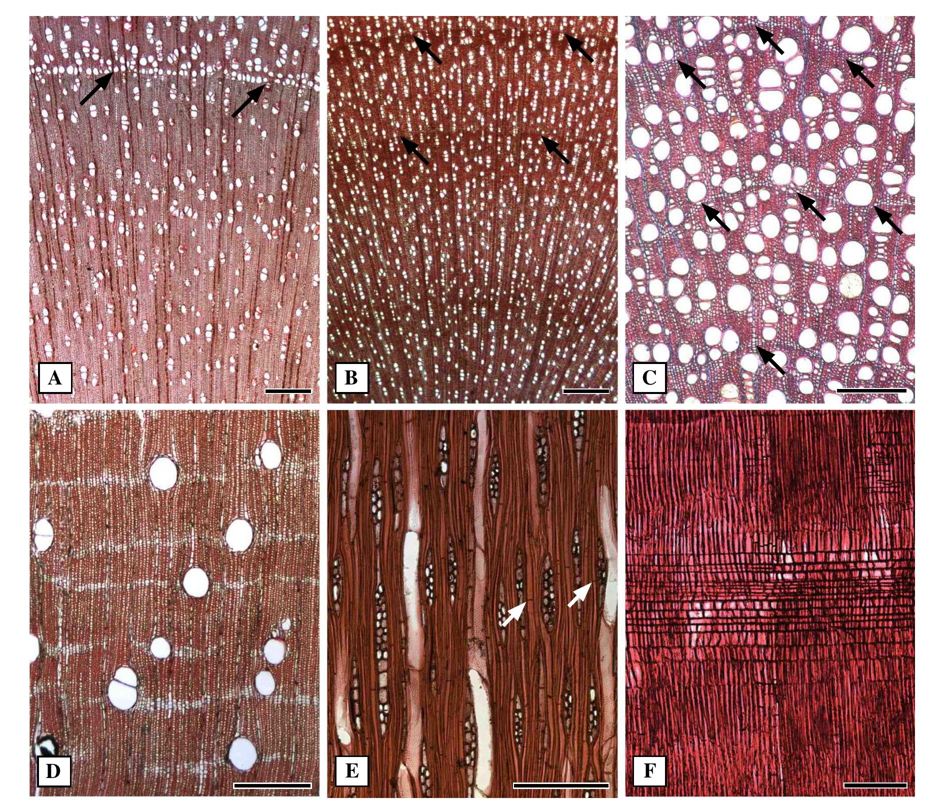 Wood anatomy of the tabebuia alliance (including crescen-