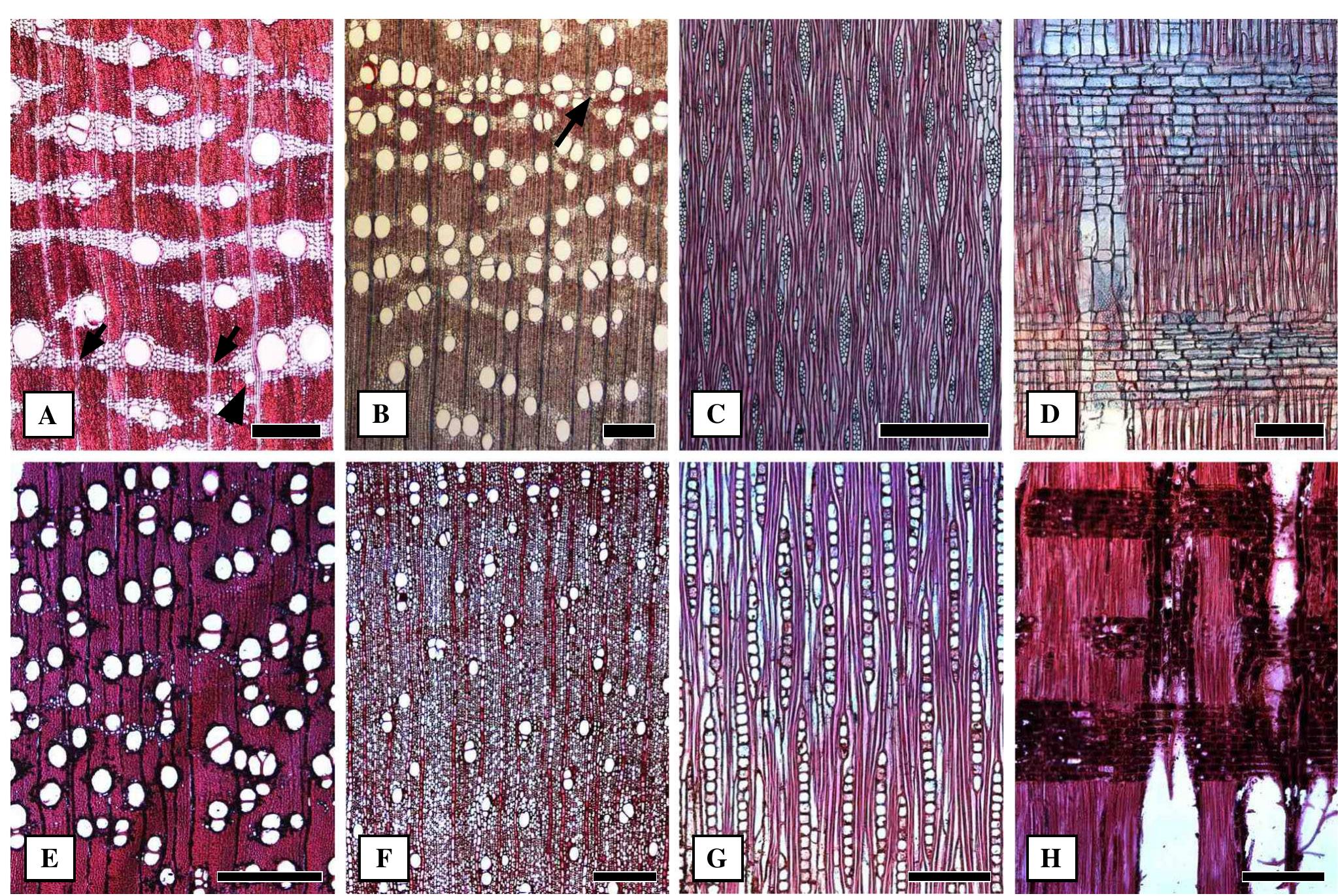 Wood anatomy of the tabebuia alliance (including crescen-