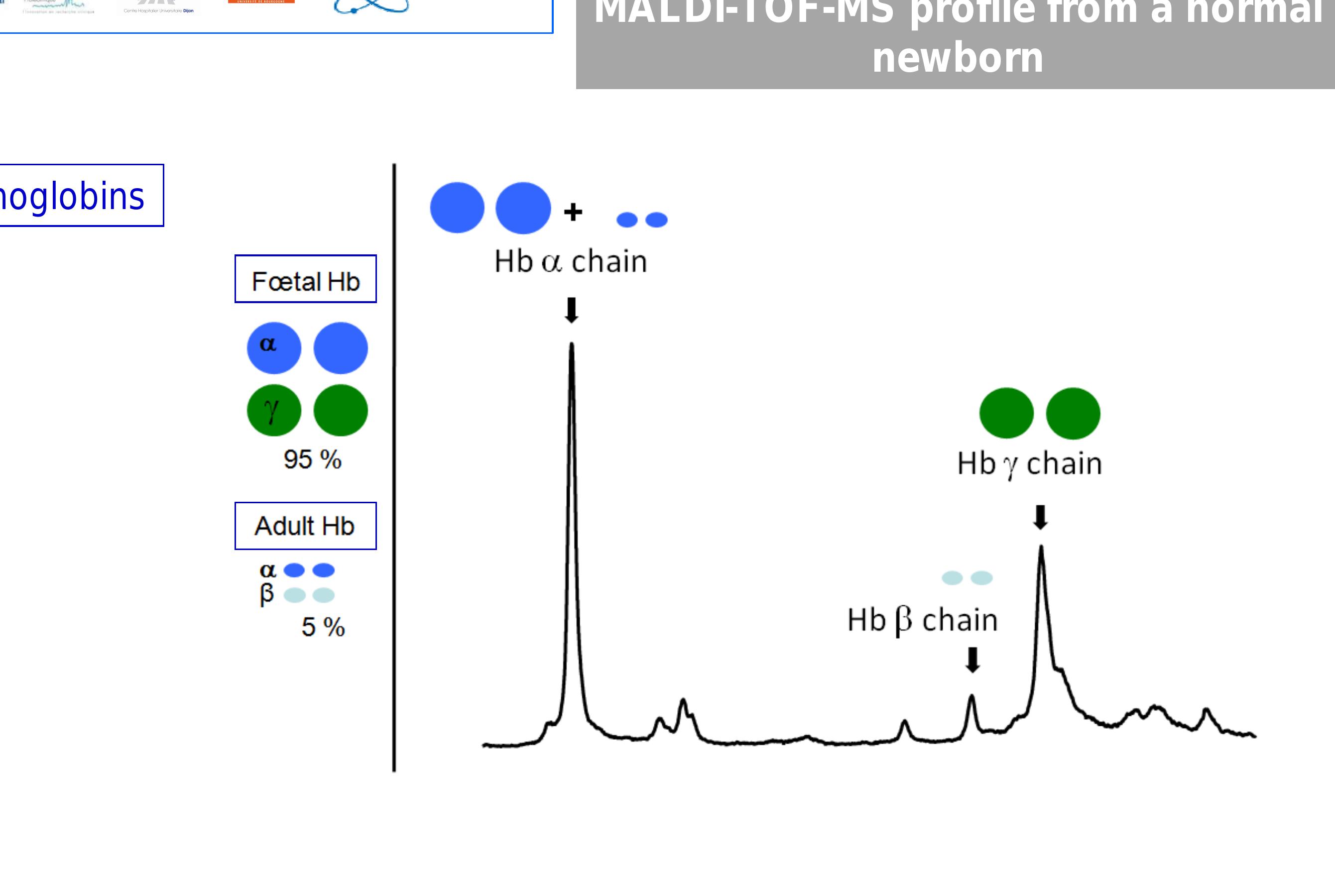 Figure 1 - from Implementation of the first MALDI-TOF MS
