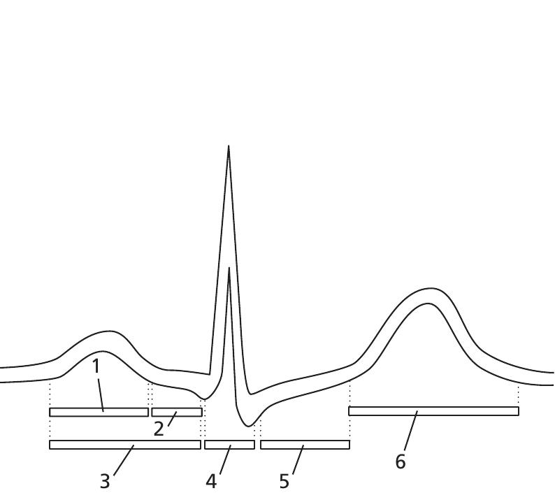Figure 264 - from ECG interpretation
