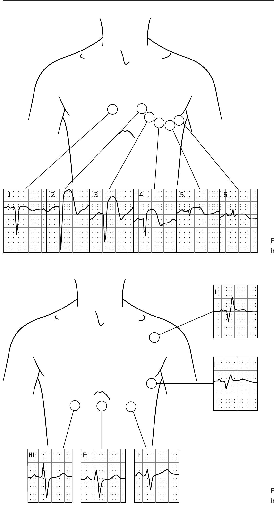 Figure 59 - from ECG interpretation