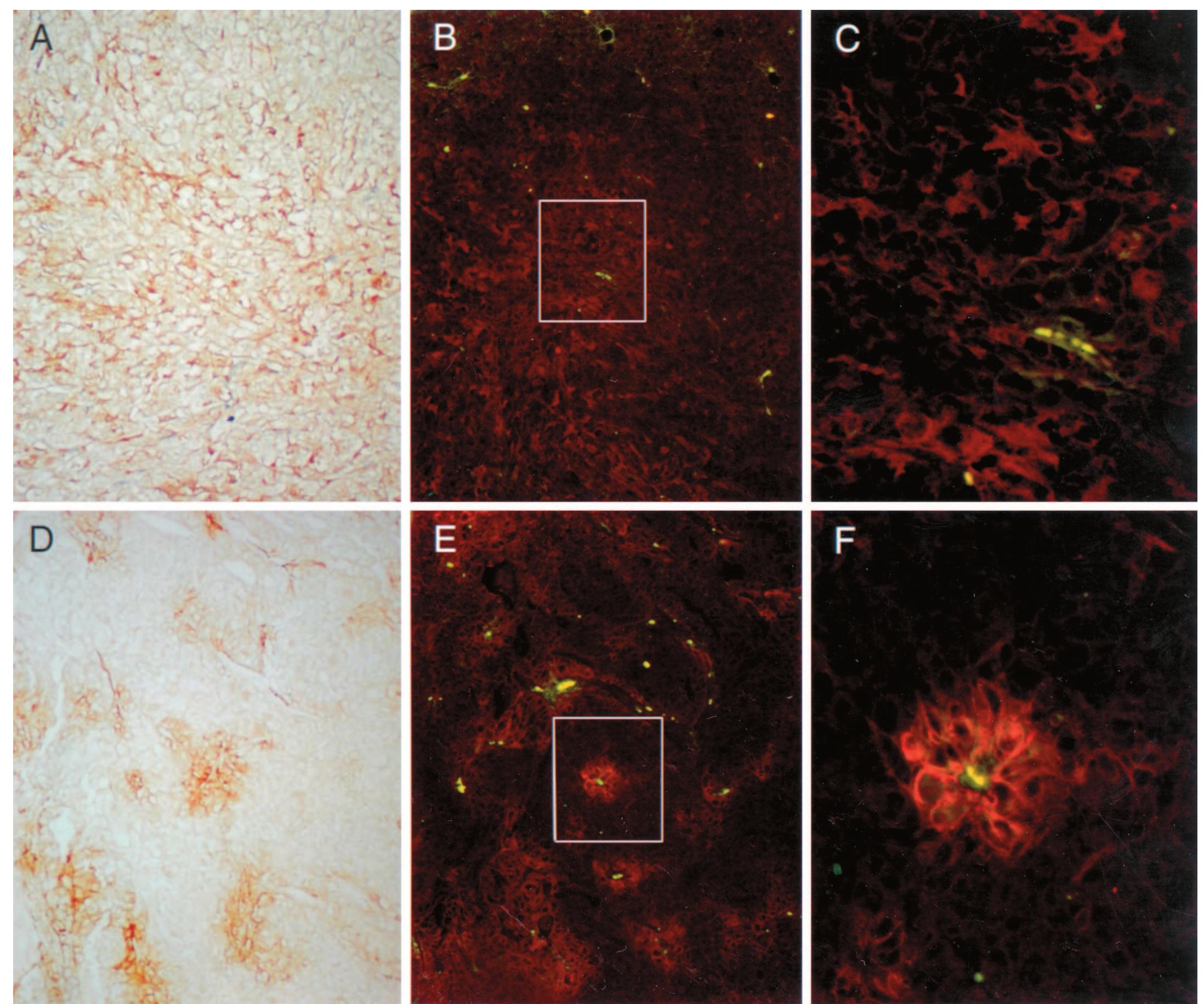 (PDF) High Affinity Restricts the Localization and Tumor Penetration of ...