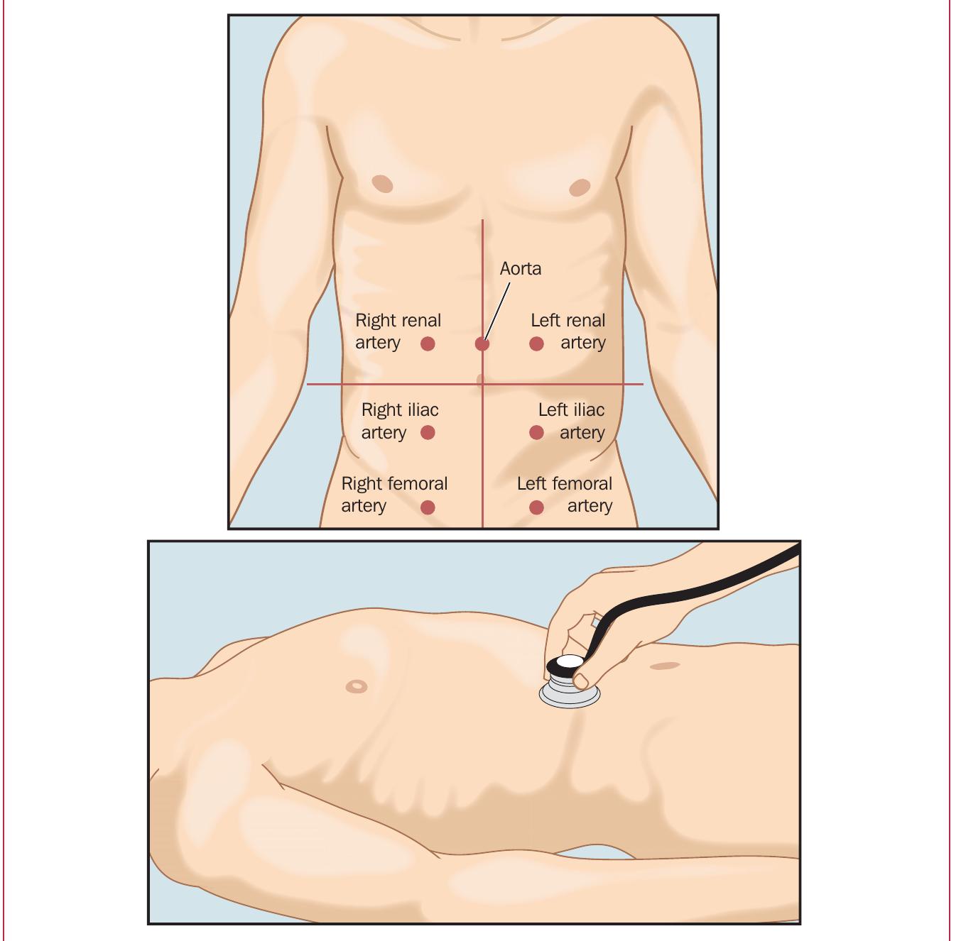 Figure 1 From A Critical Review Of Auscultating Bowel