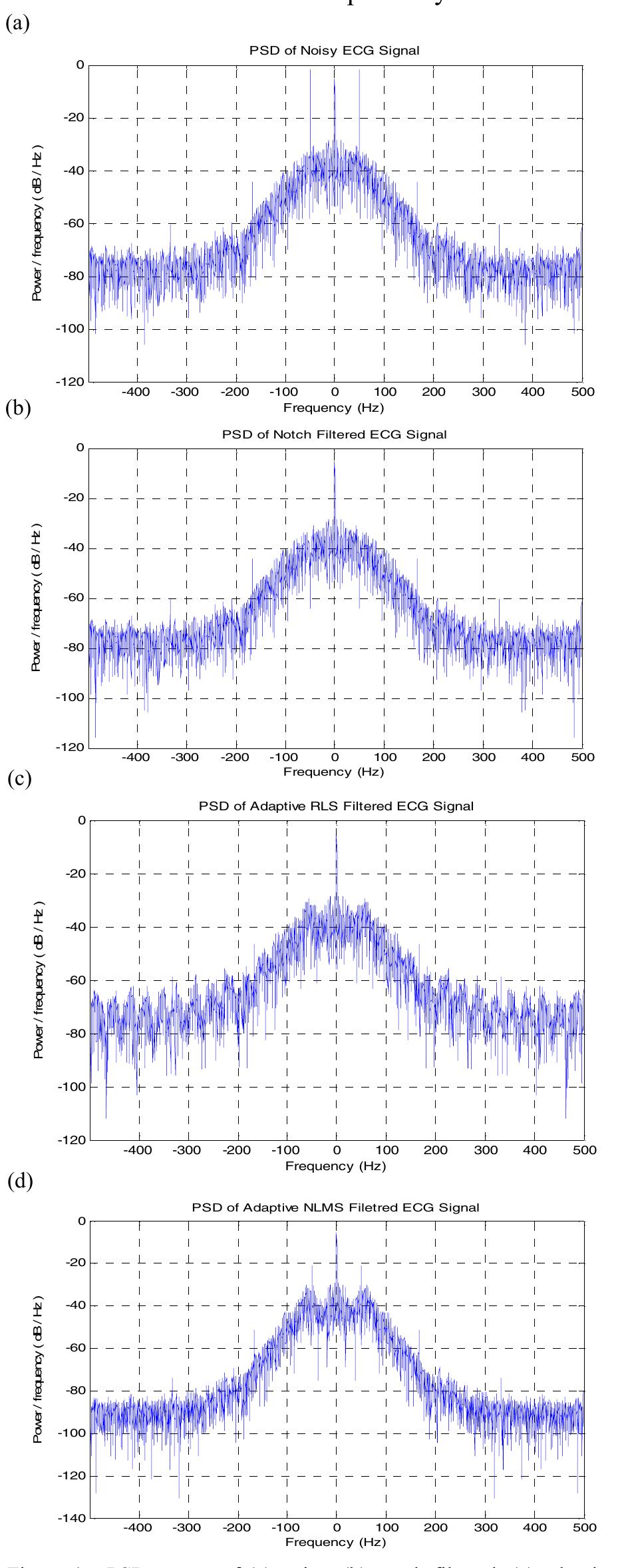 Removing Power Line Interference from ECG Signal Using Adaptive Filter ...