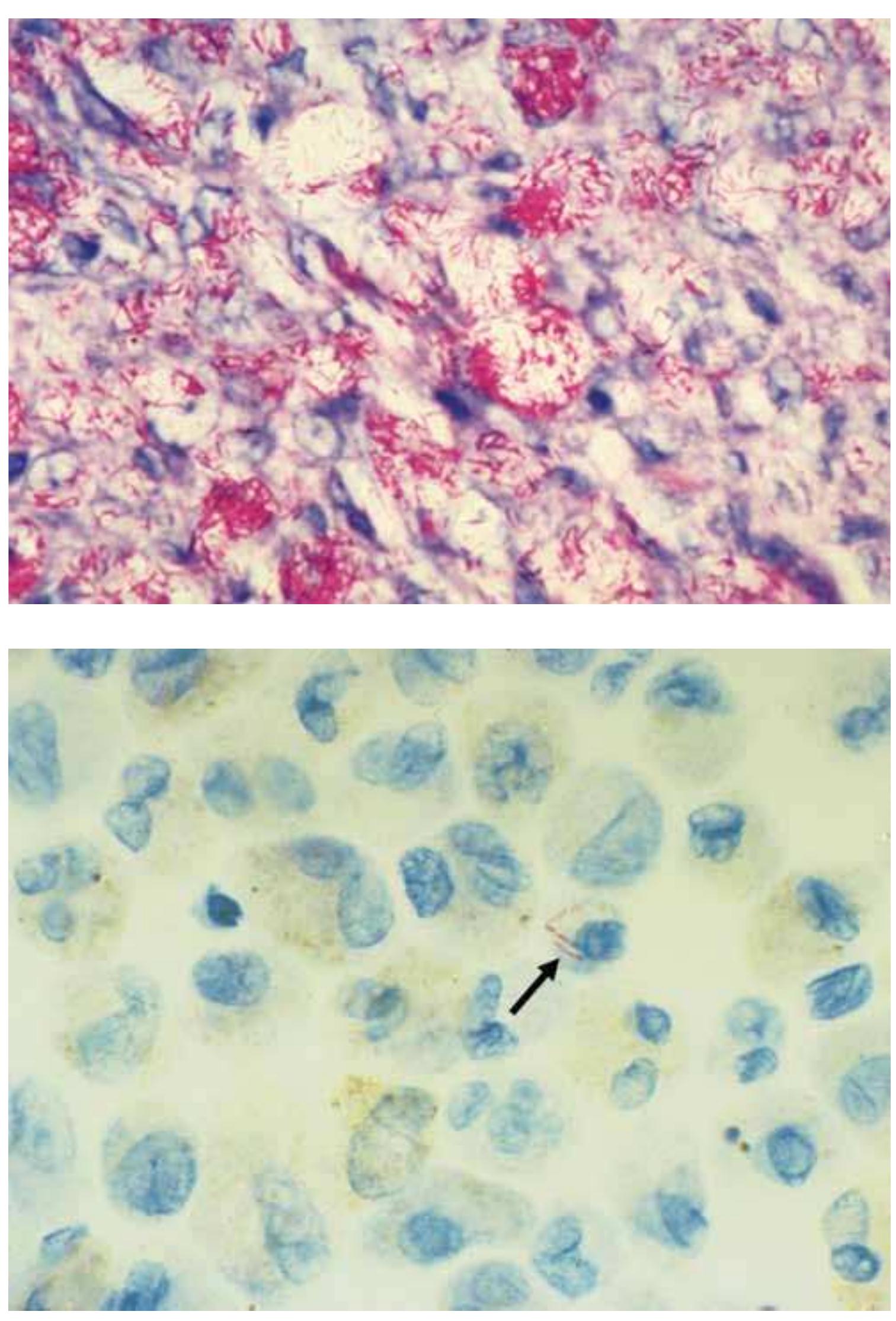 Figure 92 - Special Stains and H&E Education Guide
