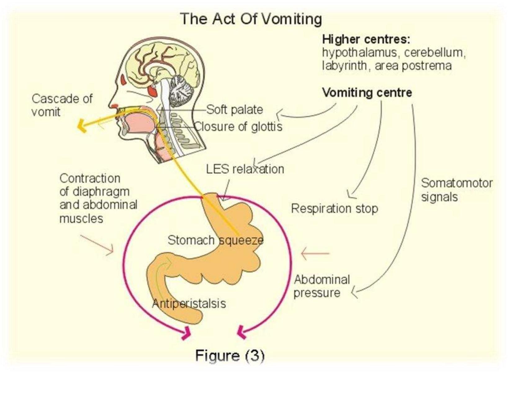 Pathophysiology Of Nausea And Vomiting Flowchart
