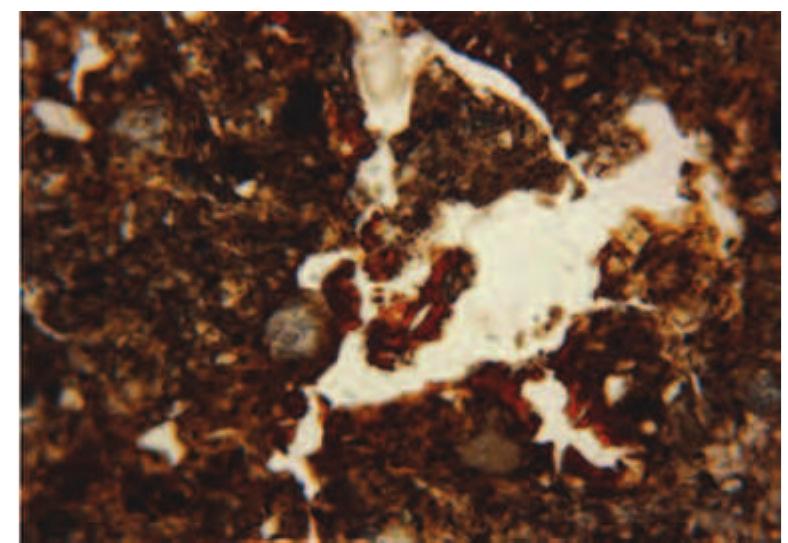 Figure 22: Photomicrograph of Phosphatic-iron infills in the voids in the humic palaeosol, upper sample 1/7 (frame width = 2.25mm; plane  polarized light)  Slika 22: Fotomikrograf fosfat- no - Zeljeznih ispuna u Supljinam u humickom paleotlu, gornji uzorak 1/7 (Sirina okvira = 2.25 mm, ravan- ska polarizovana svjetlost) 