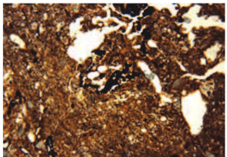 Slika 23:  Fotomikrograf jake humicke i amorfnim Zeljezom oboje- ne pjeskovito muljevite gline, uzorak 1/6 (Sirina okvira = 4.5 mm; ravan- ska polarizovana svjetlost)  Figure 23: Photomicrograph of a strongly humic and amorphous iron stained sandy silty clay, sample 1/6  (frame width = 4.5mm; plane polar- ized light) 