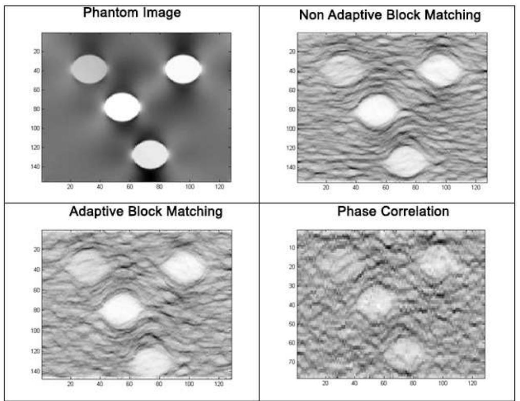 Adaptive vs. non-adaptive block matching.