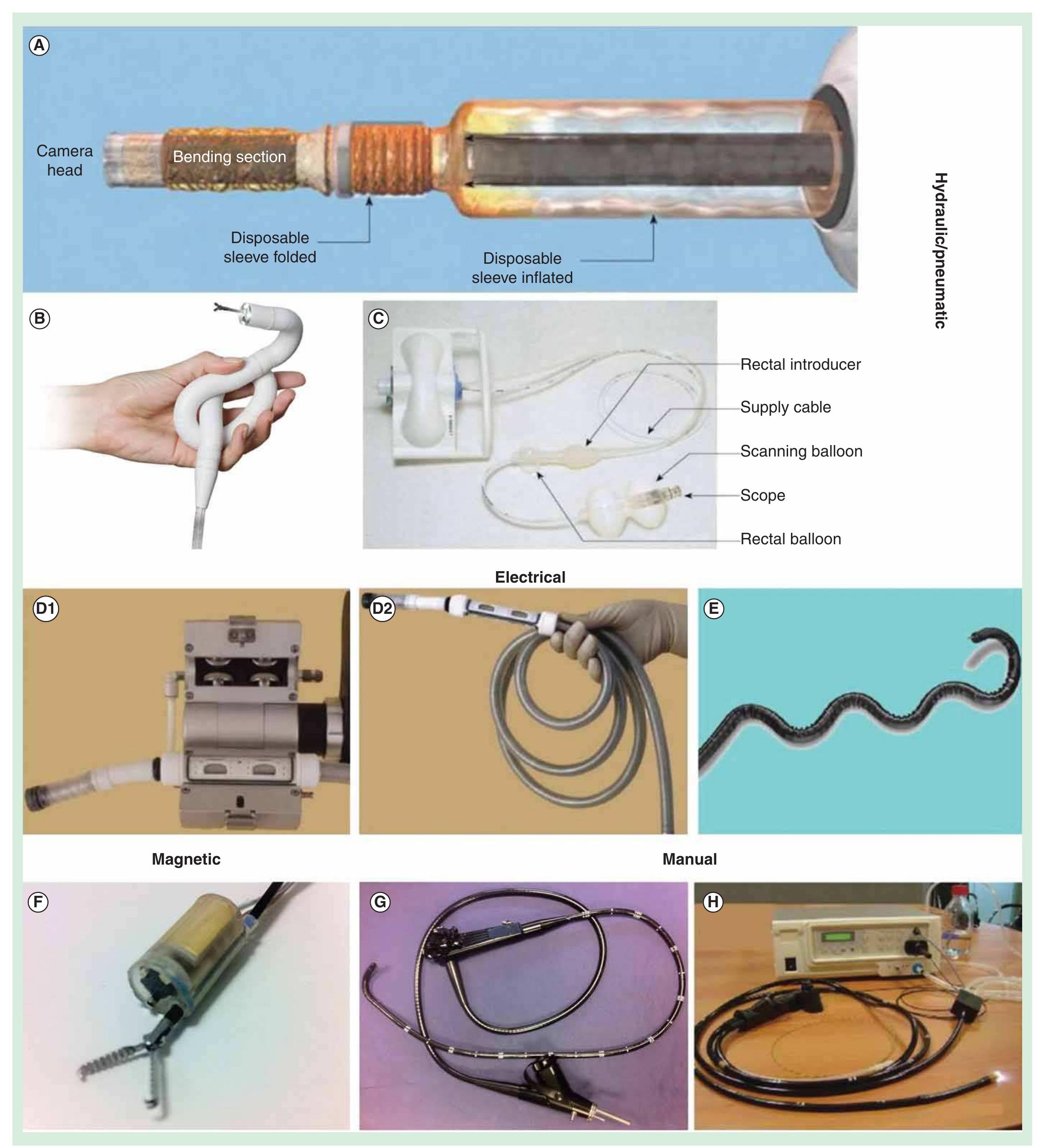 (PDF) Flexible and capsule endoscopy for screening, diagnosis and treatment