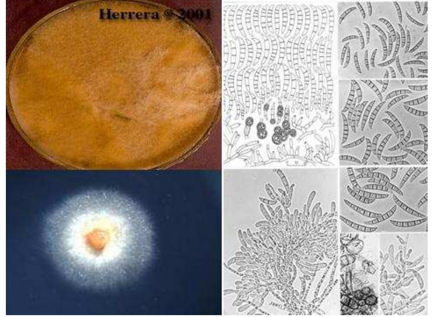 Figure 183 - Monograph on the genus Fusarium