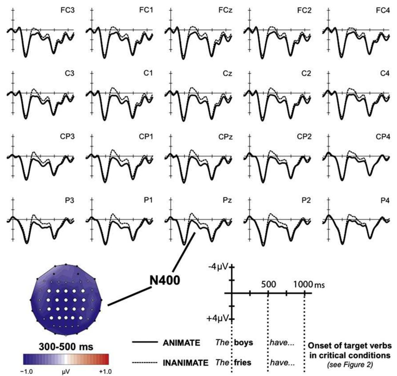 Grand average waveform and voltage map of the erps elicited