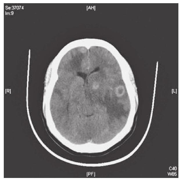 A computed tomography (ct) scan is shown in figure 33.1.