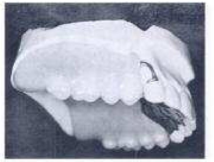 Mccracken Protesis Parcial Removible 11 Edicion www.academia.edu