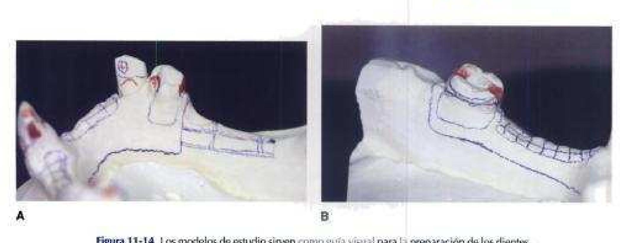 Mccracken Protesis Parcial Removible 11 Edicion www.academia.edu