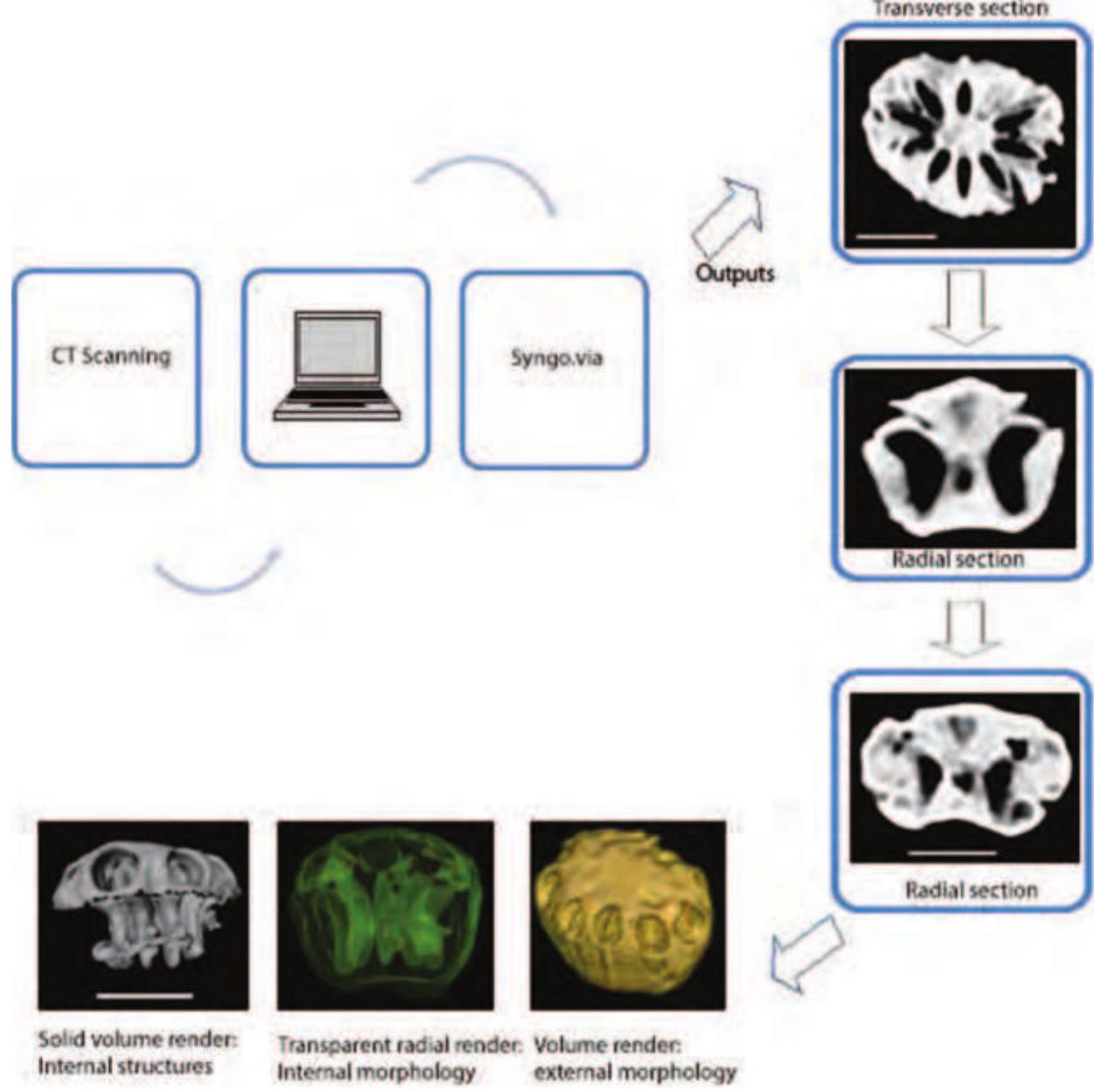 Computed tomography flowchart. qmf 57033 pleiogynium