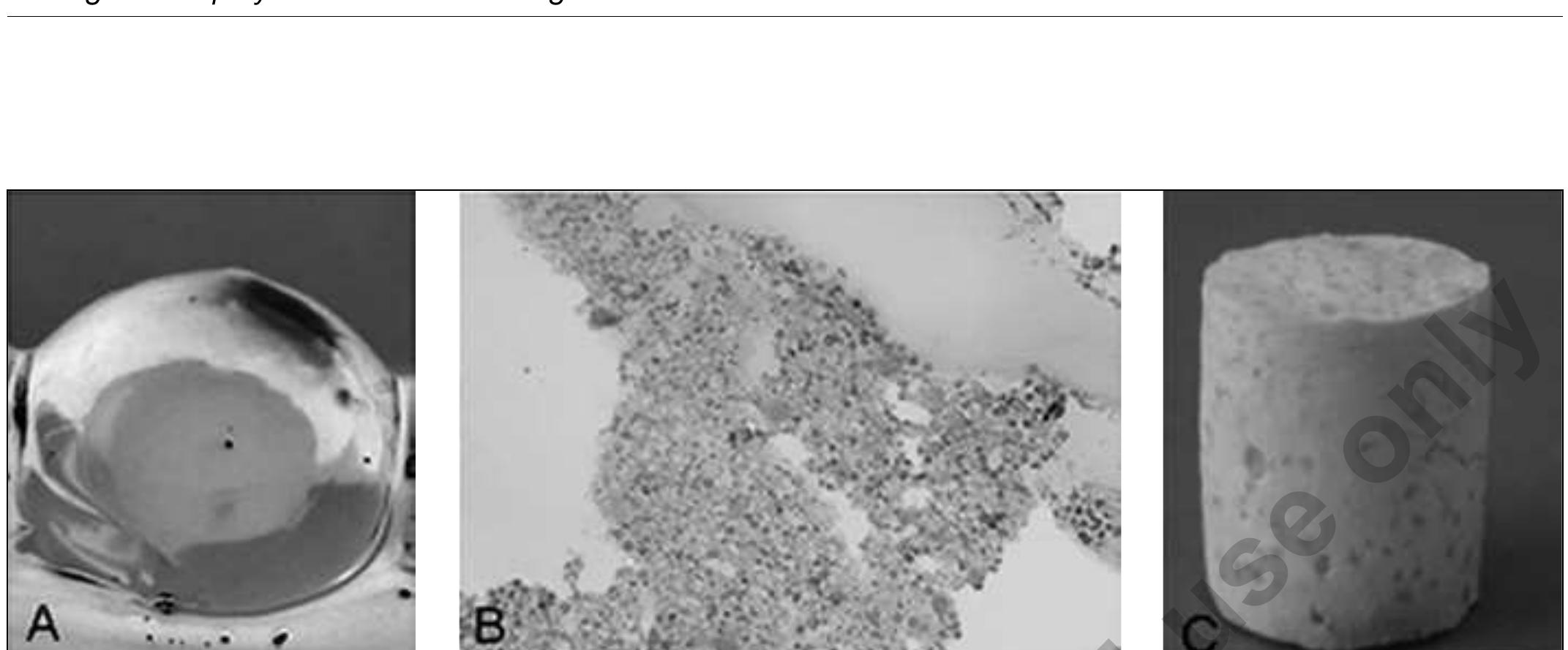 - alginate bead and pla scaffold. a) a capsular-like