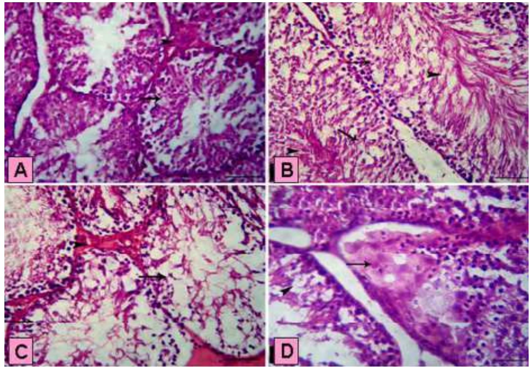 Electron microscopy (tem) of rabbit testis from the control