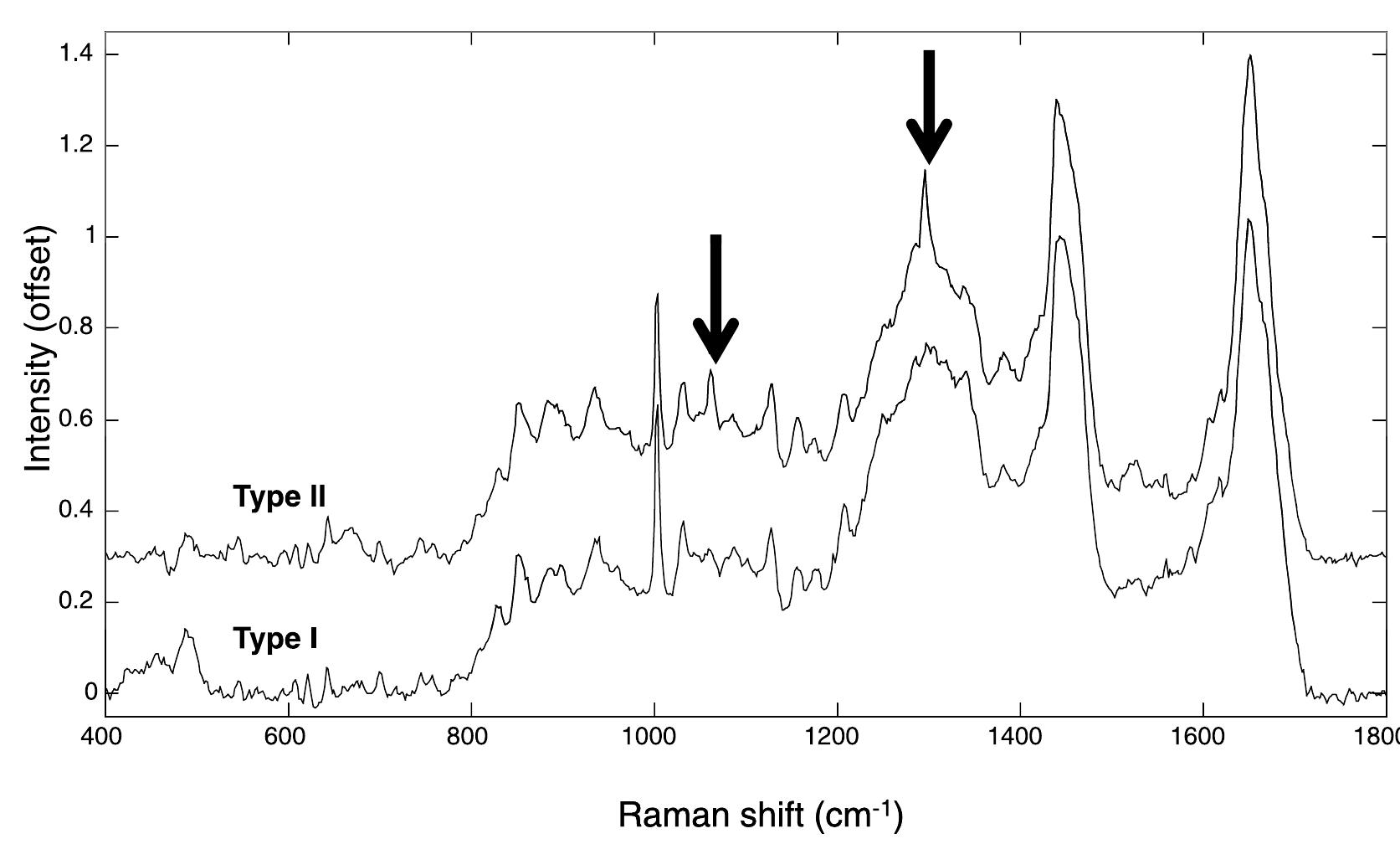 Fic. 7. in vivo raman spectra of the two types observed in