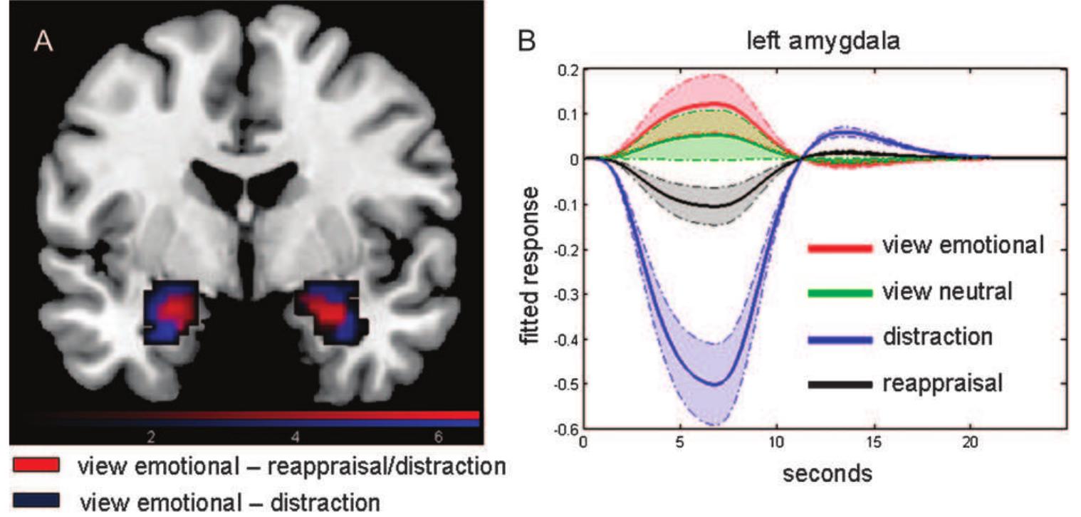 How to Regulate Emotion? Neural Networks for Reappraisal and Distraction
