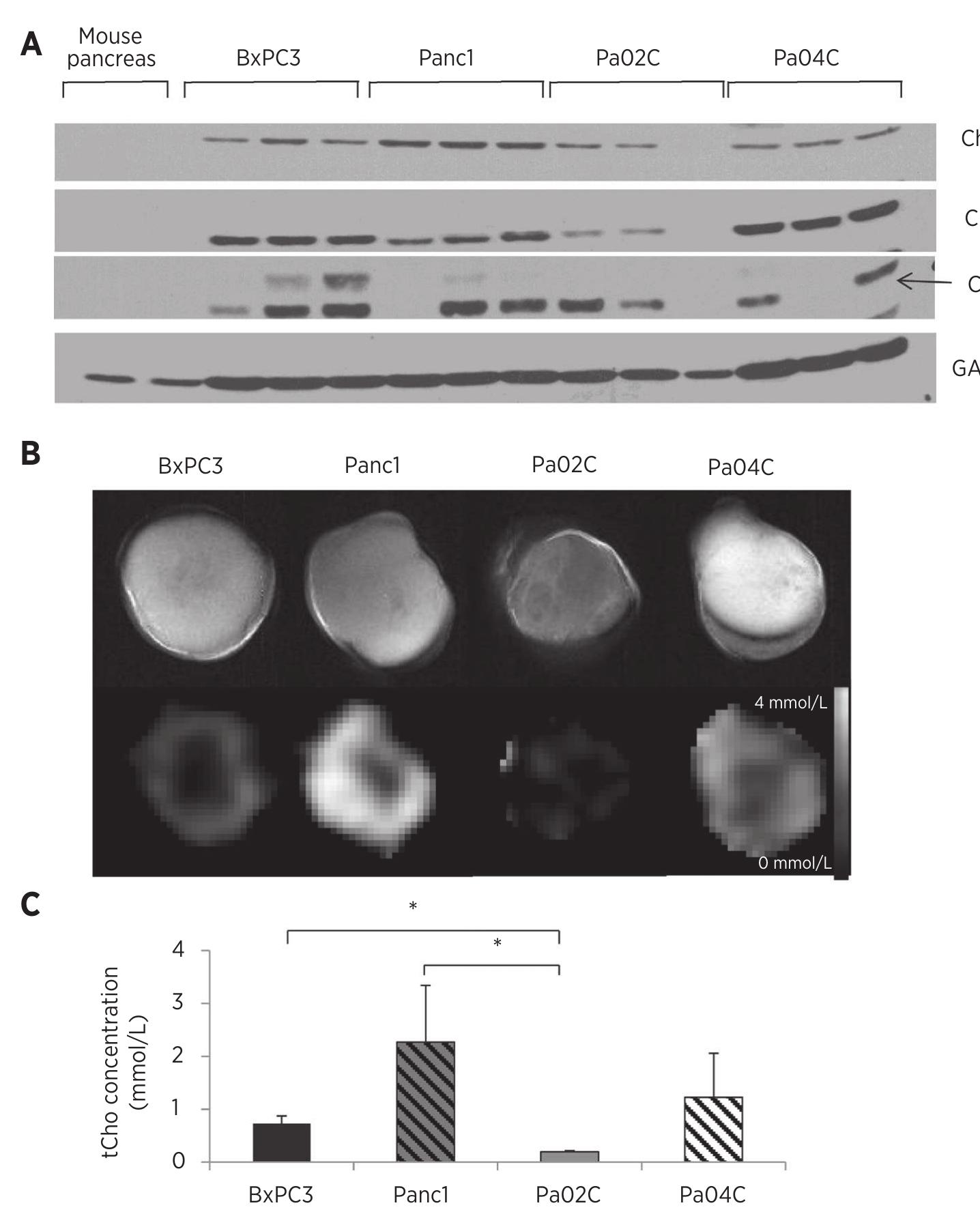 (PDF) Metabolic Imaging of Pancreatic Ductal Adenocarcinoma Detects ...
