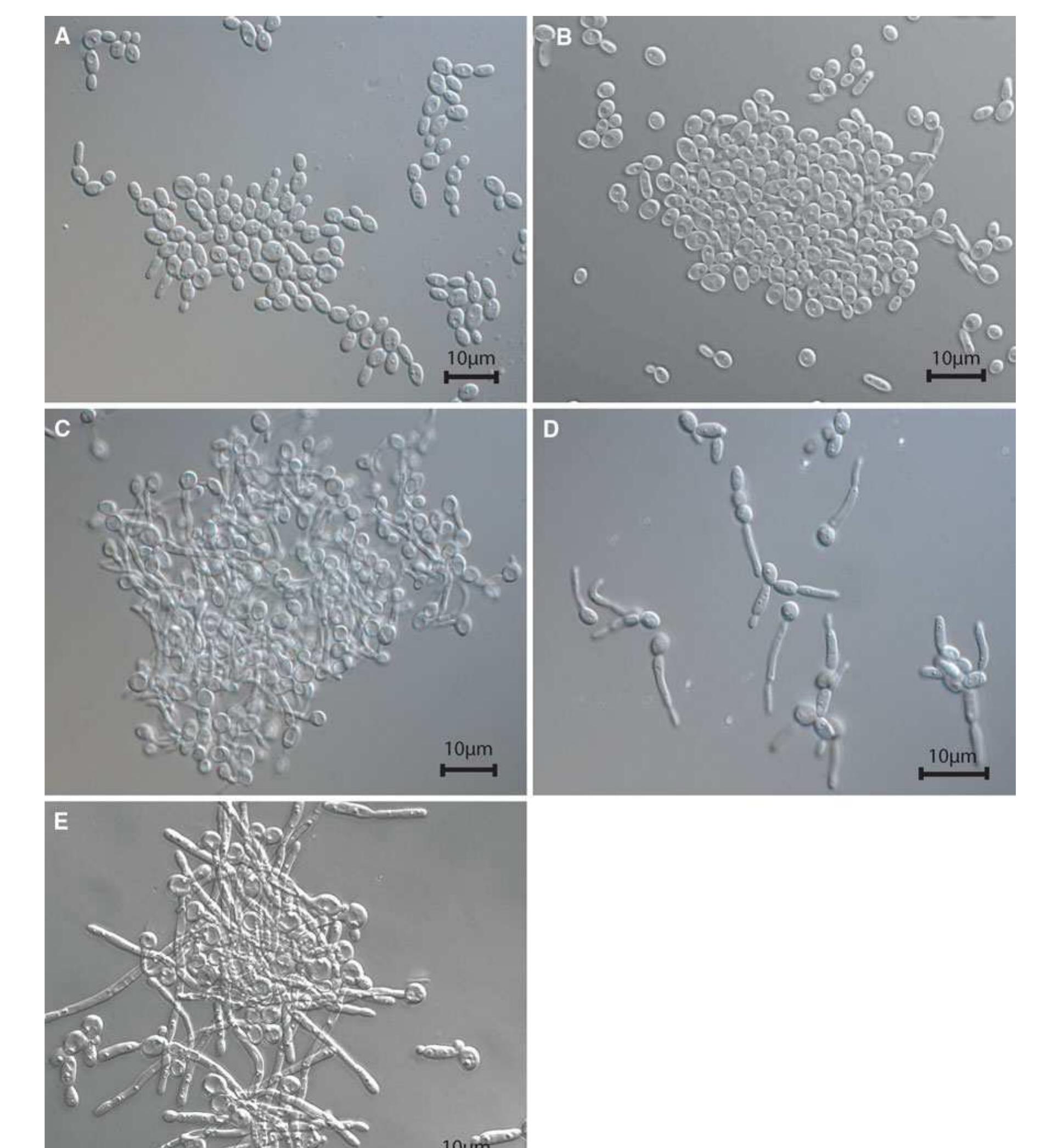(PDF) Metabolome analysis during the morphological transition of ...