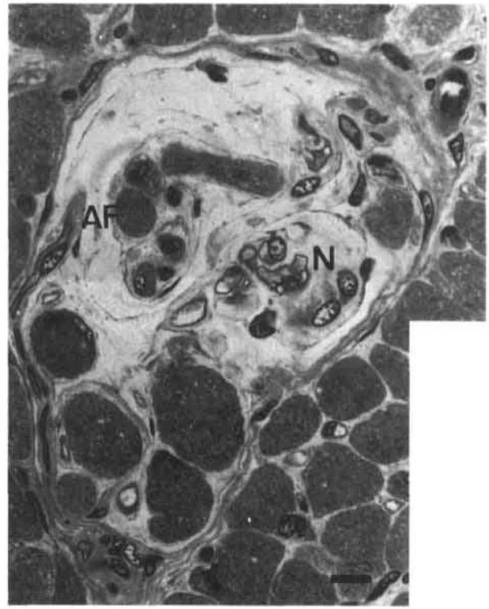 Fuor Chaino Ficure 3. semi-thin cross section through a muscle spindle