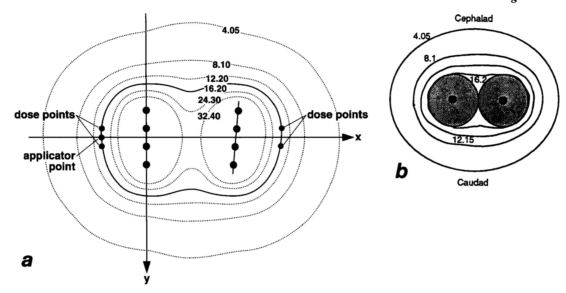 A: transverse isodose plot through the plane of the