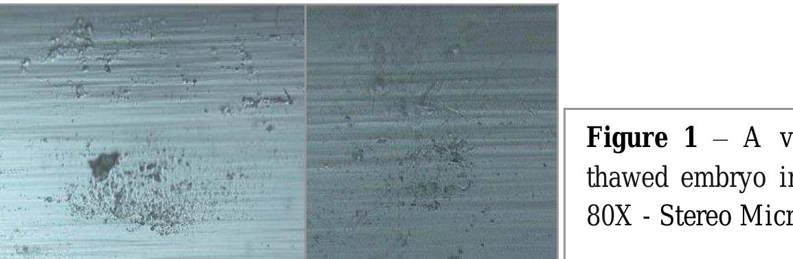 PDF) Comparative Analysis of Hsp10 and Hsp90 Expression in Healthy
