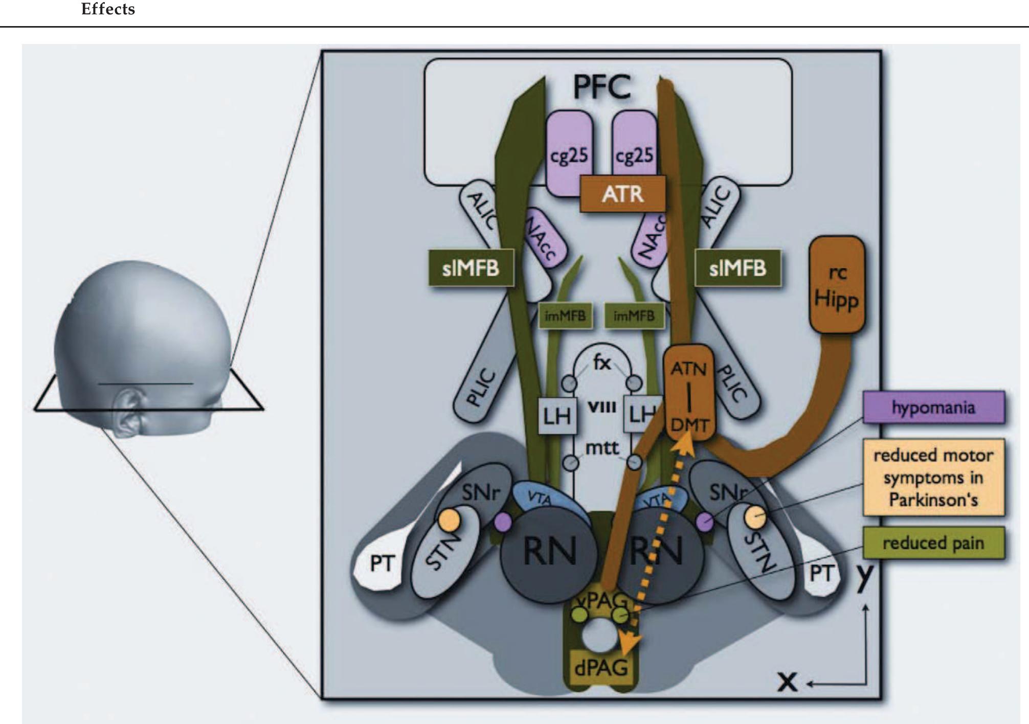 Figure 1 - from Human Medial Forebrain Bundle (MFB) and