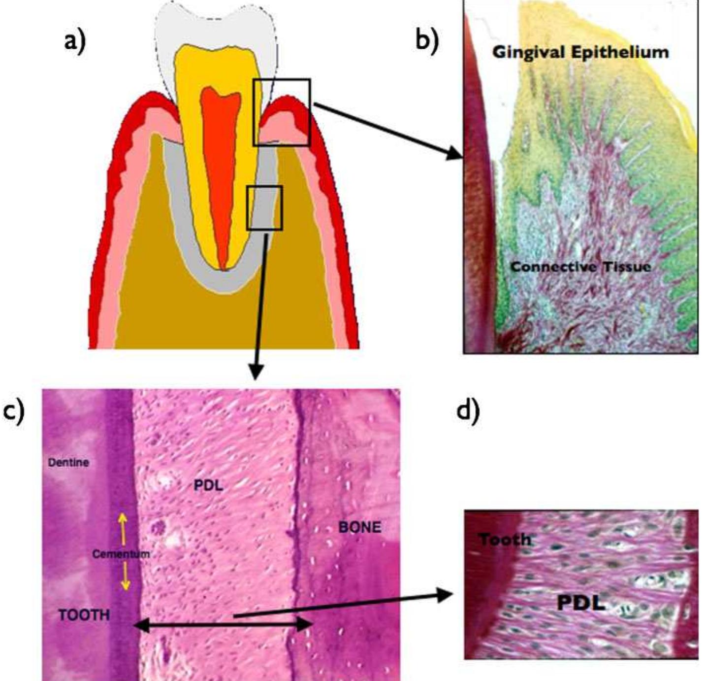 (PDF) Periodontal regeneration: a challenge for the tissue engineer?