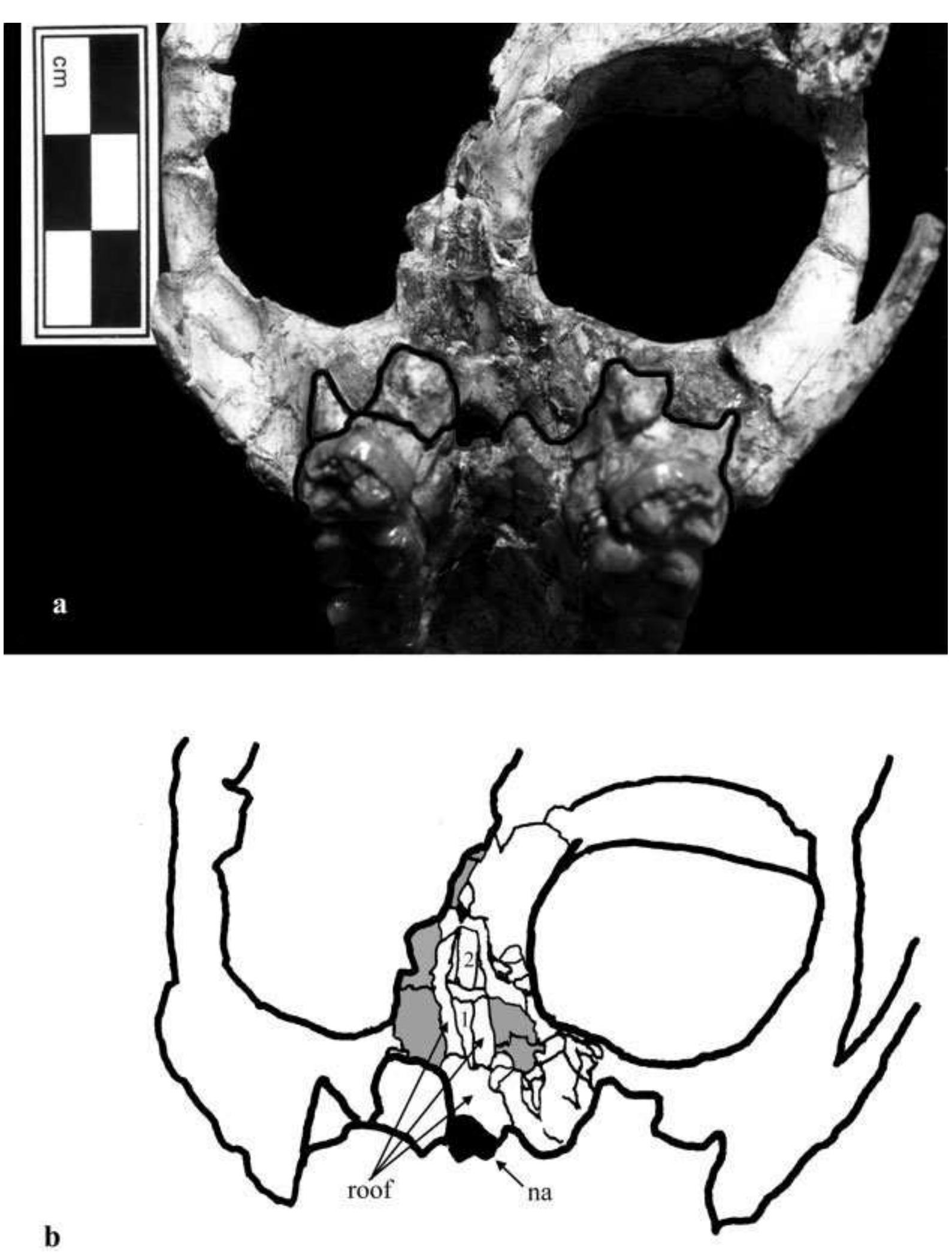 (PDF) Anatomy of the nasal cavity and paranasal sinuses ...