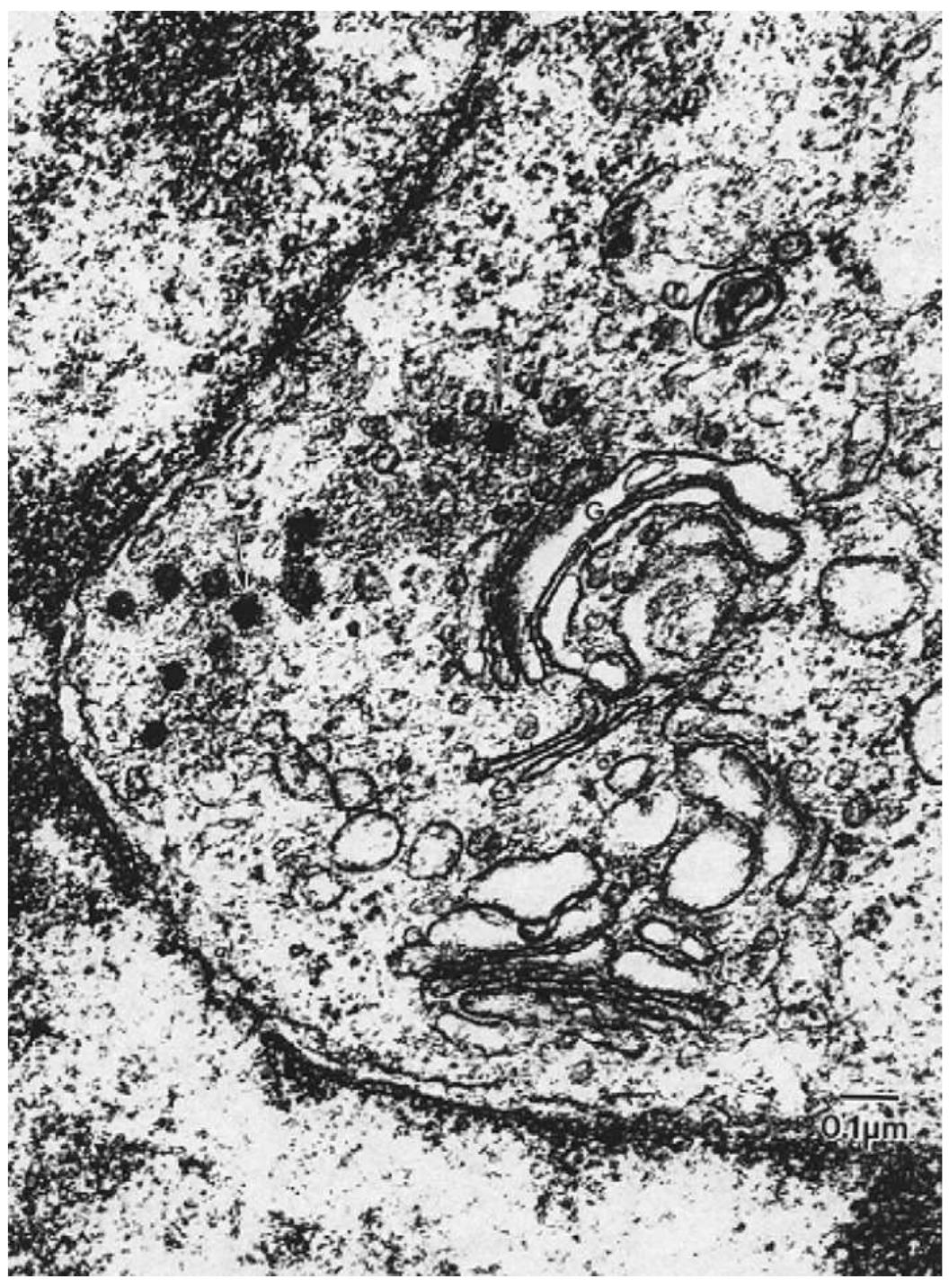 Transmission electron microscopy photo of cho cells used to