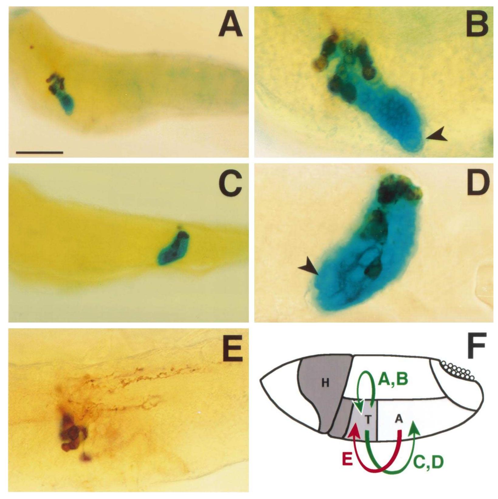 Nb Example Examples of late larval nb lineages originating from